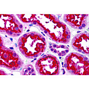 Anti-TAB3 (RABBIT) Antibody, 100µg, Liquid (sterile filtered)