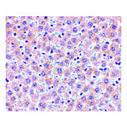 Anti-sRANK Ligand (RABBIT) Antibody, 100µg, Liquid (sterile filtered)