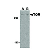 Anti-TOR (RABBIT) Antibody, 100µg, Liquid (sterile filtered)