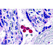 TLR4 Antibody cterm 100µg