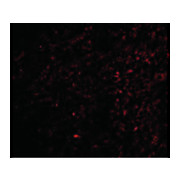 TOCA-1 Antibody nterm 100µg