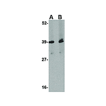 Anti-UROP11 (RABBIT) Antibody, 100µg, Liquid (sterile filtered)