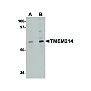 TMEM214 Antibody nterm 100µg