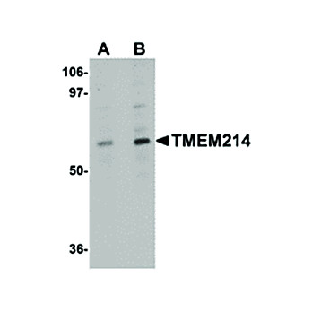 TMEM214 Antibody nterm 100µg