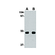 Anti-Unc93a (RABBIT) Antibody, 100µg, Liquid (sterile filtered)