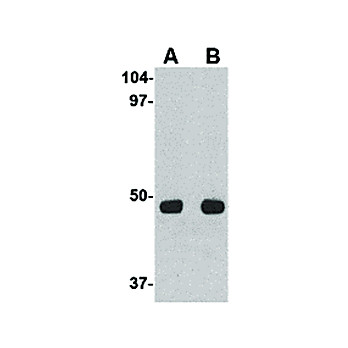 Anti-Unc93a (RABBIT) Antibody, 100µg, Liquid (sterile filtered)
