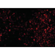 TRPC6 Antibody cterm 100µg