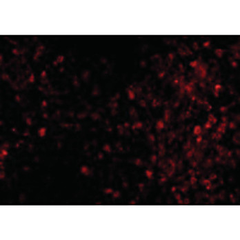 TRPC6 Antibody cterm 100µg