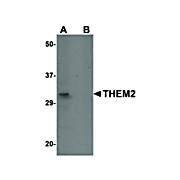 Anti-THEM2 (RABBIT) Antibody, 100µg, Liquid (sterile filtered)