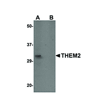 Anti-THEM2 (RABBIT) Antibody, 100µg, Liquid (sterile filtered)