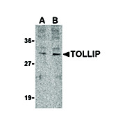 TOLLIP Antibody cterm 100µg
