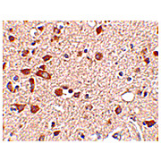 Stk39 Antibody internal 100µg