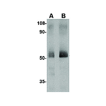 Anti-Spred2 (RABBIT) Antibody, 100µg, Liquid (sterile filtered)