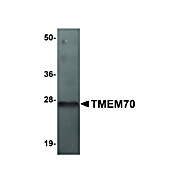 Anti-TMEM70 (RABBIT) Antibody, 100µg, Liquid (sterile filtered)