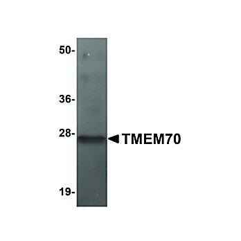 Anti-TMEM70 (RABBIT) Antibody, 100µg, Liquid (sterile filtered)