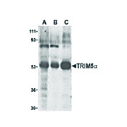 TRIM5 alpha Antibody mky 100µg
