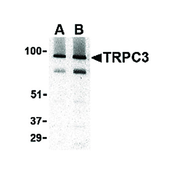 TRPC3 Antibody cterm 100µg