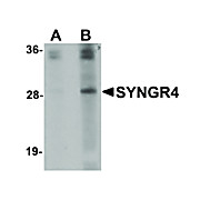 Anti-SYNGR4 (RABBIT) Antibody, 100µg, Liquid (sterile filtered)