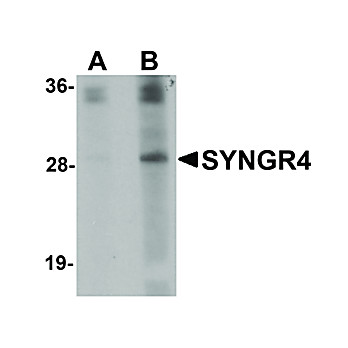 Anti-SYNGR4 (RABBIT) Antibody, 100µg, Liquid (sterile filtered)