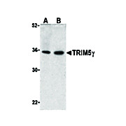Anti-TRIM5 gamma (RABBIT) Antibody, 100µg, Liquid (sterile filtered)