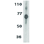TCCR Antibody nterm 100µg