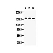 Anti-ABCB11 (RABBIT) Antibody, 100µg, Lyophilized