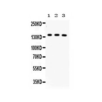 Anti-ABCB11 (RABBIT) Antibody, 100µg, Lyophilized