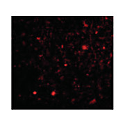 TOCA-1 Antibody cterm 100µg