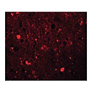 Anti-SRPX1 (RABBIT) Antibody, 100µg, Liquid (sterile filtered)
