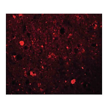 Anti-SRPX1 (RABBIT) Antibody, 100µg, Liquid (sterile filtered)