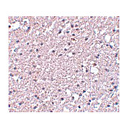 Anti-TMEM184A (RABBIT) Antibody, 100µg, Liquid (sterile filtered)