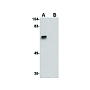 Anti-ZBRK1 (RABBIT) Antibody, 100µg, Liquid (sterile filtered)