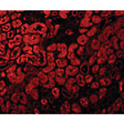 ACE2 - cterm Antibody 100µg