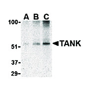 Anti-TANK (RABBIT) Antibody, 100µg, Liquid (sterile filtered)