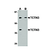 Anti-TCTN3 (RABBIT) Antibody, 100µg, Liquid (sterile filtered)