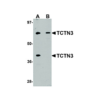 Anti-TCTN3 (RABBIT) Antibody, 100µg, Liquid (sterile filtered)