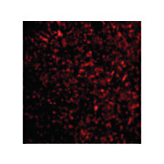 STEAP3 Antibody 100µg