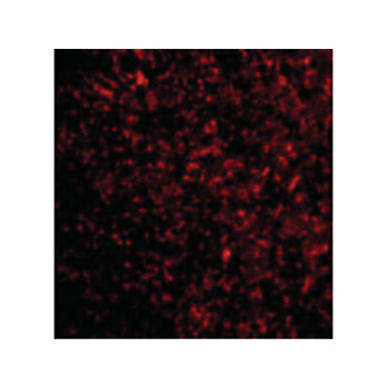 STEAP3 Antibody 100µg