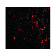 TEM7 Antibody internal 100µg