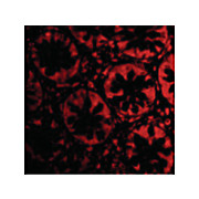 TEM2 Antibody nterm 100µg