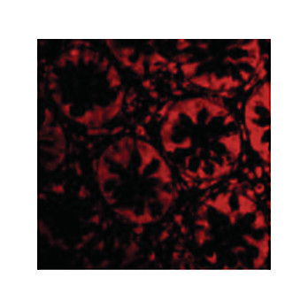 TEM2 Antibody nterm 100µg
