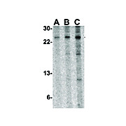 Tslp Antibody internal ms 100µg