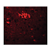 Anti-TRIM71 (RABBIT) Antibody, 100µg, Liquid (sterile filtered)