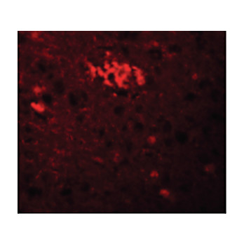 Anti-TRIM71 (RABBIT) Antibody, 100µg, Liquid (sterile filtered)