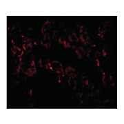 TNFAIP3 Antibody cterm 100µg