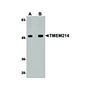 TMEM214 Antibody internal 100µg
