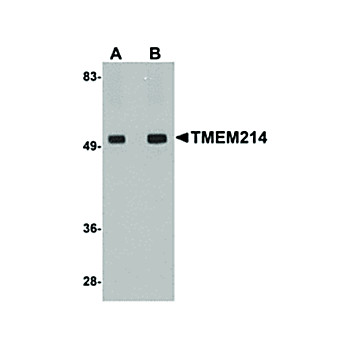 TMEM214 Antibody internal 100µg