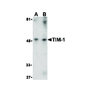 TIM-1 Antibody internal 100µg