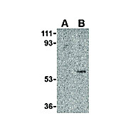 Anti-Toso (RABBIT) Antibody, 100µg, Liquid (sterile filtered)