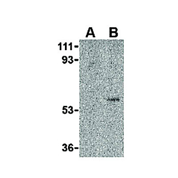 Anti-Toso (RABBIT) Antibody, 100µg, Liquid (sterile filtered)